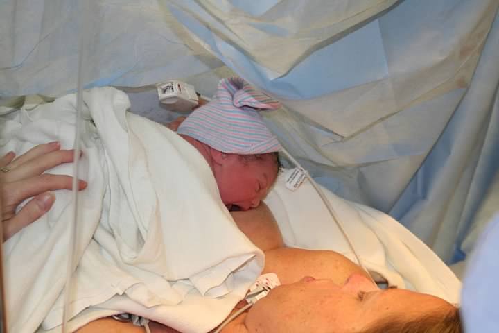 DawnA C-Section Birth